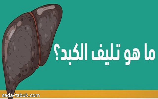 مدينة الملك سعود الطبية: تليف الكبد حالة مرضية وهناك 4 خطوات لتقليل الإصابة به