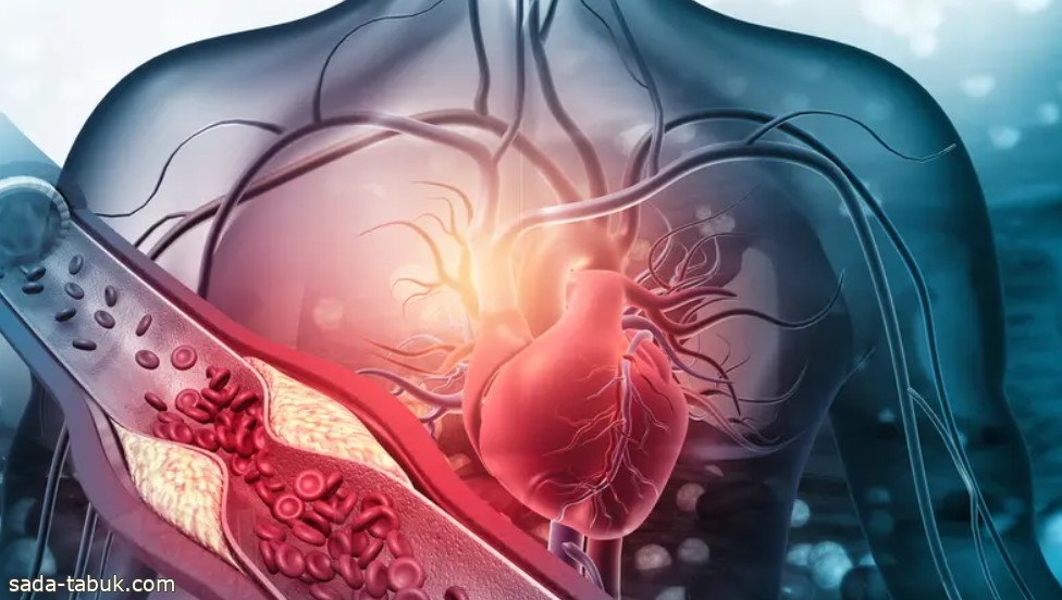 لتجنب النوبات القلبية والتحكم بالضغط.. 8 عادات مذهلة