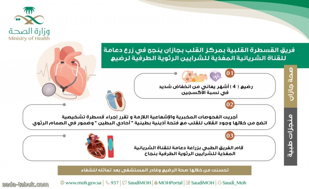 فريق القسطرة  القلبية  بمركز  القلب  بجازان  ينجح  في زراعة دعامة للقناة الشريانية المغذية  للشرايين الرئوية الطرفية لرضيع